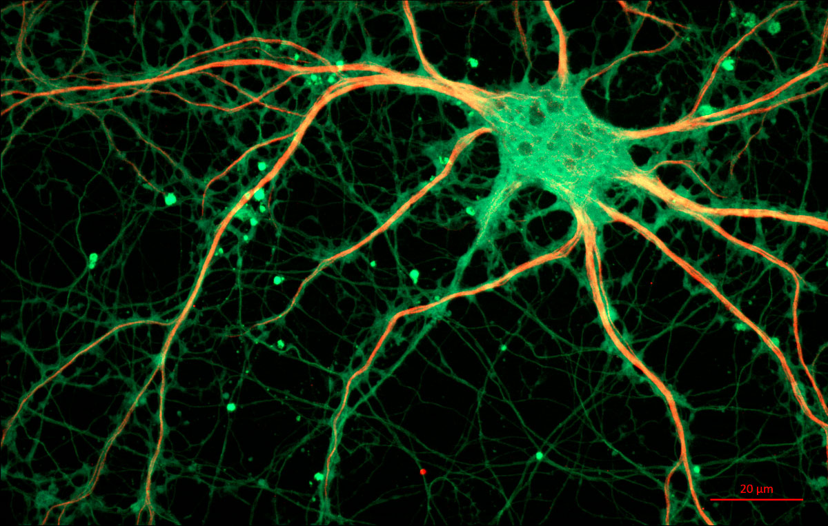 Cultured_Rat_Hippocampal_Neuron_(24327909026)